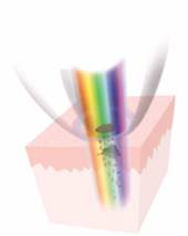 Multispectral dermatoscopy 
