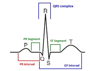 ECG_marked