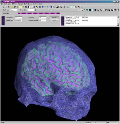 neuroimaging