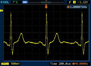 AVR DDS simulated ECG signal