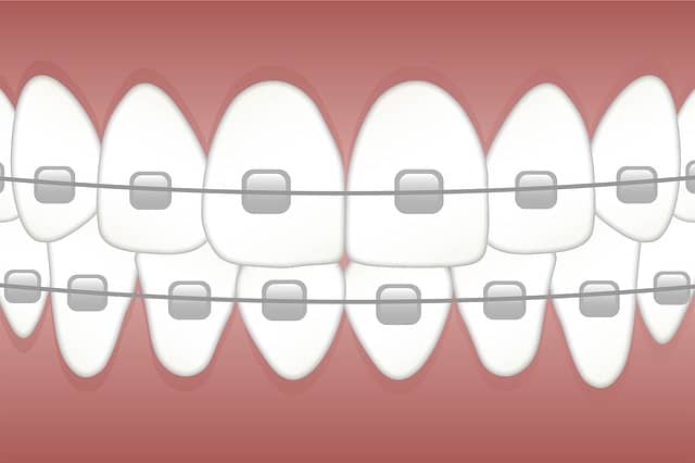 orthodontist treatments
